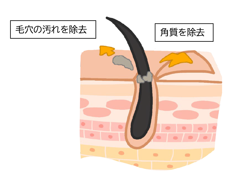 サリチル酸マクロゴールピーリング