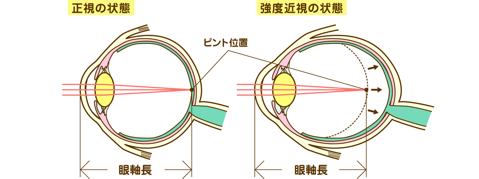 ピント位置